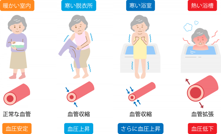 断熱されていないお風呂場で高くなるヒートショックのリスク